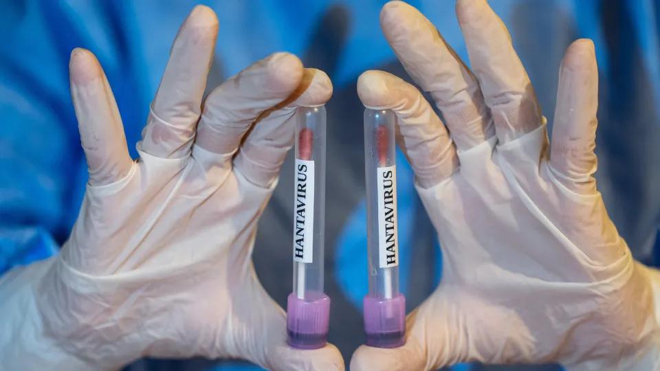 Primeiro caso suspeito de hantavírus em Portugal dá negativo