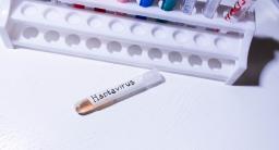 Hantavírus: União Europeia recebe antiviral experimental doado pelo Japão