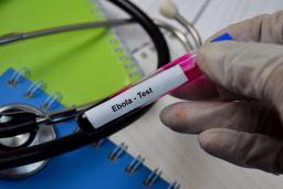 Epidemia de Ébola poderá ser "duas a quatro vezes" superior a estimativas