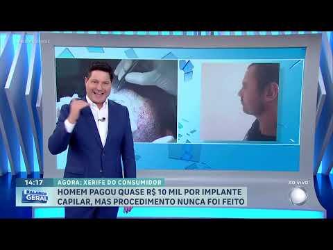 Xerife do Consumidor: Cliente recupera valor de implante capilar não realizado após três anos