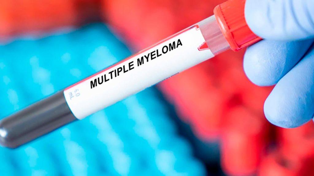 Mieloma múltiplo em foco: Diretor Clínico de HBS alerta para aumento preocupante de casos em Cabo Verde